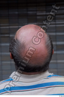 Street  654 bald hair head 0002.jpg